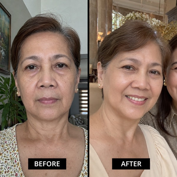 Real customer before and after result