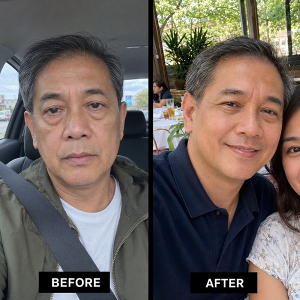 Real customer before and after result